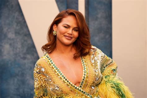 Chrissy Teigen Sets The Record Straight On New Face After Plastic Surgery Criticism