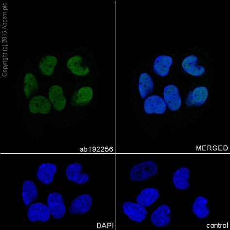 recombinant anti runx2 antibody [epr14334] bsa and azide free ab240329