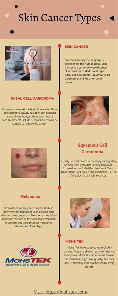 Skin Cancer Types And Treatment Skin Cancer Treatment Pdq Patient
