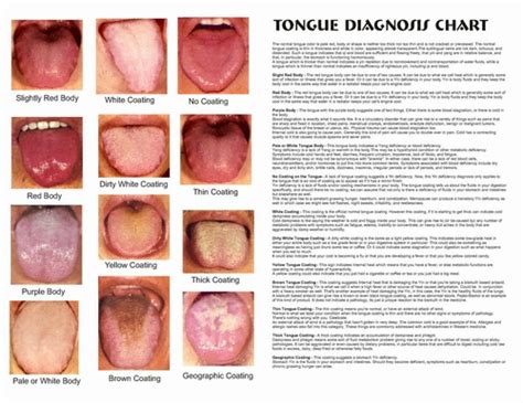 Coated Tongue Indicates