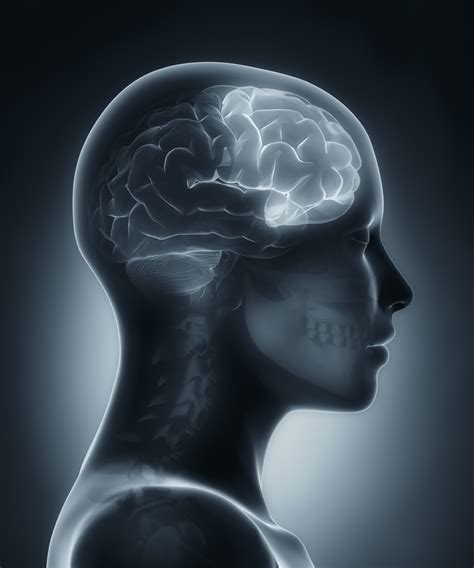 Frontal lobe medical x-ray scan - Restore Behavioral Health