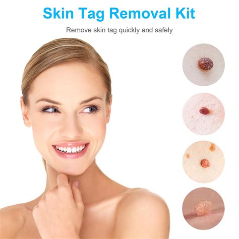 50pcs skin tag removal kit skin tag remover skin mole wart remover micro band skin tag removal