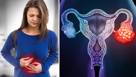 5 Signs That Could Mean Ovarian Cancerearly Stages Are Hard To Detect