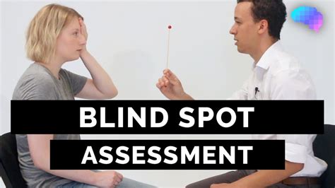 Blind Spot Assessment Osce Guide Youtube