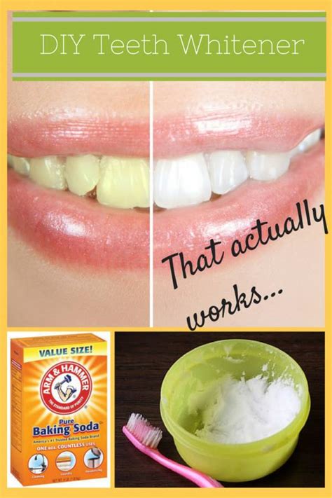 How To Make Teeth Extremely White Teethwalls