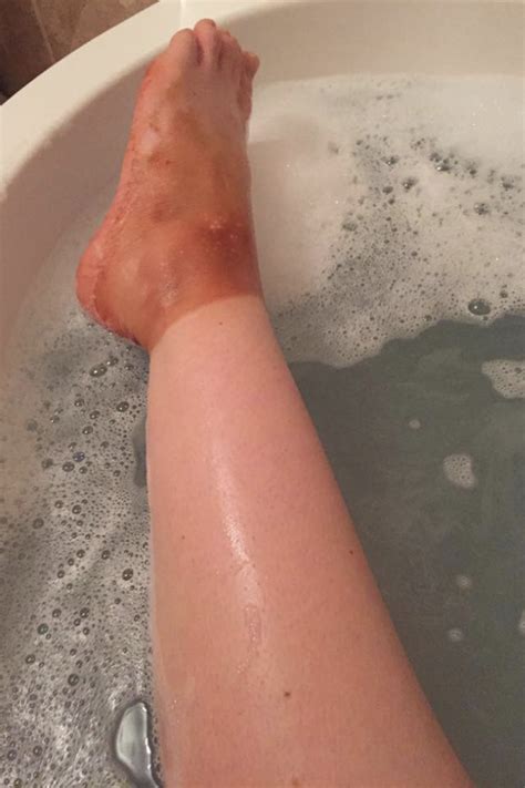 Fake Tan Fail Teen Turns Mums Foot Orange Tanning With Her Sock Ok