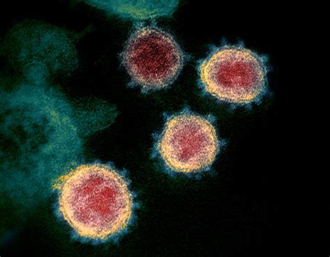 変異した新型コロナウイルスが優勢に 過剰な心配は不要 | ナショナルジオグラフィック日本版サイト