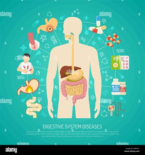 Enfermedades Del Sistema Digestivo La Ilustración Enfermedades Del