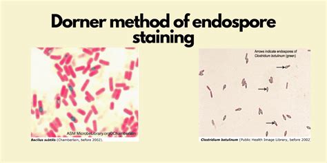 Dorner Method Of Endospore Staining Procedure Principle