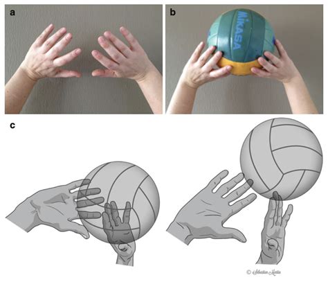 La Mainch Understanding Finger Injuries In Ball Sports Volleyball