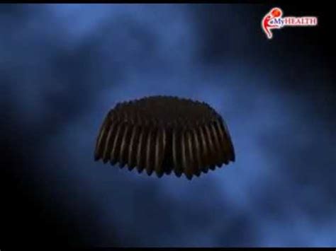Itulah jumlah air bertakung yang diperlukan untuk nyamuk aedes membiak. Kitaran hidup nyamuk Aedes - YouTube