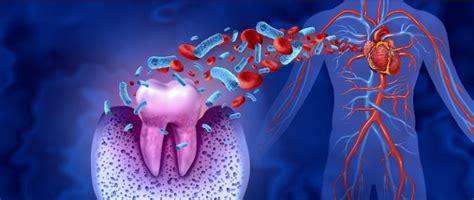 Ways Gum Disease Can Jeopardize Your Overall Health Afshin Salamati