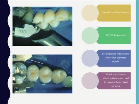 Minimally Invasive Dentistry Ppt