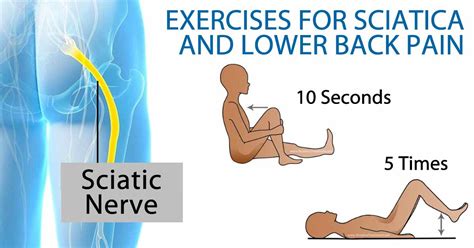 Exercises To Relieve Sciatica And Low Back Pain Favero Chiropractic