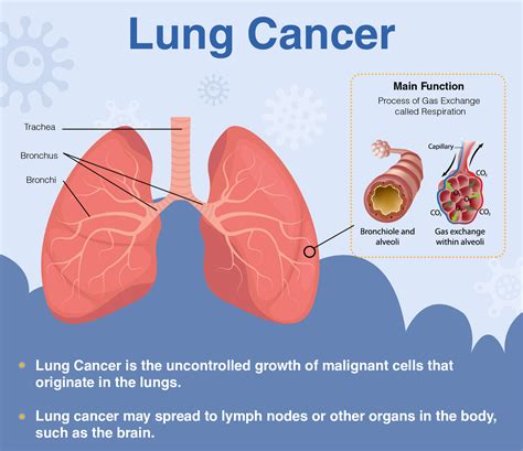 Lung cancer symptoms may also differ depending on whether a person is male or female. Overview of Lung Cancer: Signs, Symptoms, Diagnosis ...