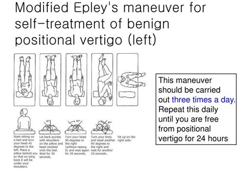 Epley Maneuver Image 3840 The Best Porn Website