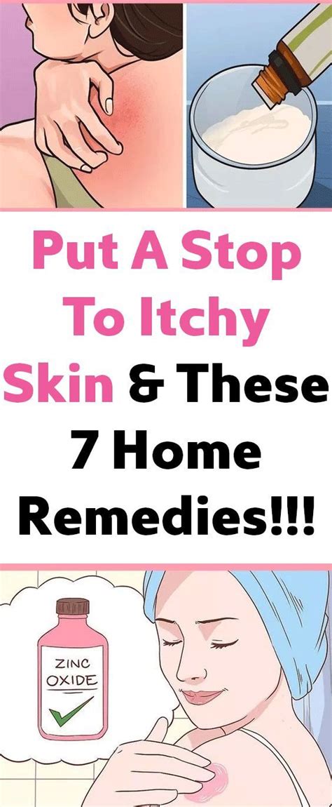 Put A Stop To Itchy Skin And These 7 Home Remedies 33 Healthy For