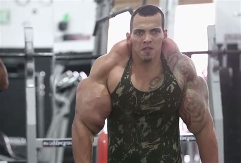 Muscle Injections Almost Cost This Brazilian Bodybuilder His Arms Bicep Muscle Muscle