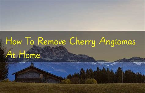 How To Remove Cherry Angiomas At Home