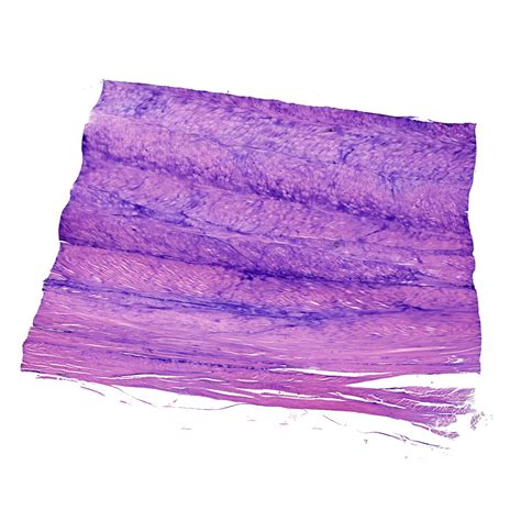 Fibrocartilage Histology