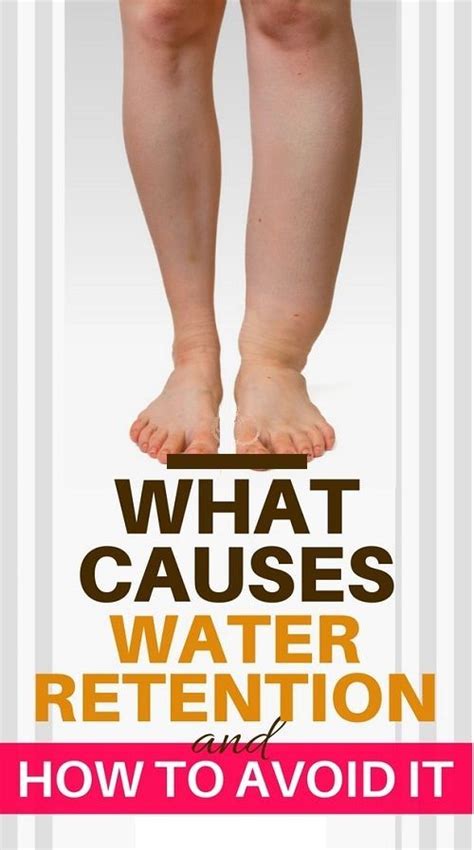 What Causes Water Retention And How To Avoid It Healthy Lifestyle