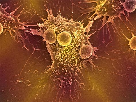 Premiere Cancer Une Nouvelle Méthode Utilise Crispr Cas9 Sciences