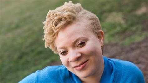 People Of Color With Albinism Ask Where Do I Belong Minnesota