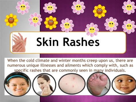 Frequent Winter Rashes And Skin Disorders Fully Grasp Some Typical