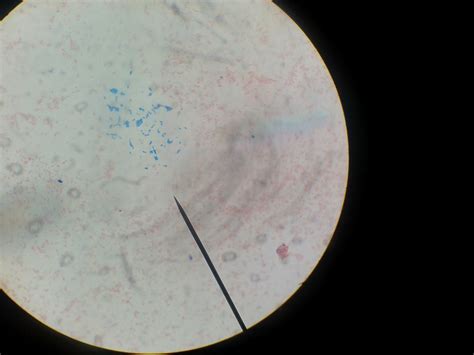 Microbiology Ejournal Day 21 Endospores Test Results Were On Gram