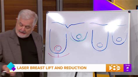 How soon can i go back to work after breast augmentation? Cost For Breast Lift - $2500 - YouTube