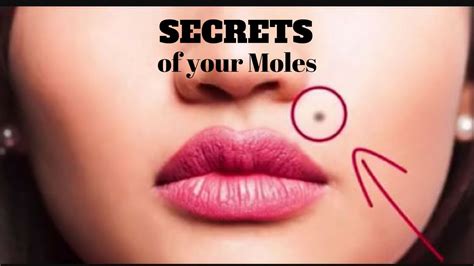 Moles On 1 Of These 7 Spots On Your Body Has A Surprising Meaning