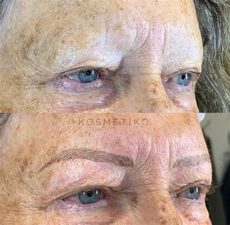Microblading For All Ages Kosmetiko Huddersfields Finest Clinical