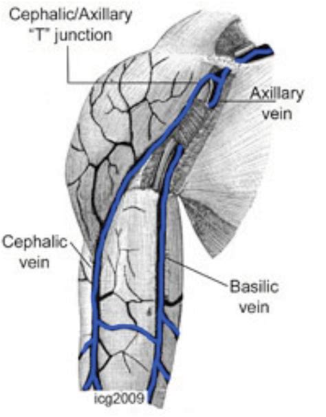 Veins Of The Upper Arm Veins Upper Arms Iv Therapy
