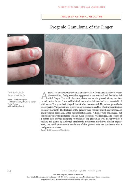 Pdf Images In Clinical Medicine Pyogenic Granuloma Of The Finger