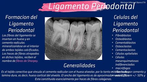 Espessamento Do Ligamento Periodontal
