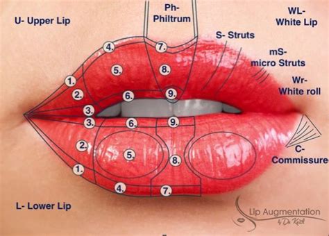 Dr Keith Lip Codes Lip Augmentation Facial Aesthetics Dermal