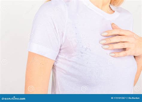 Close Up Asian Woman With Hyperhidrosis Sweating Young Asia Woman With