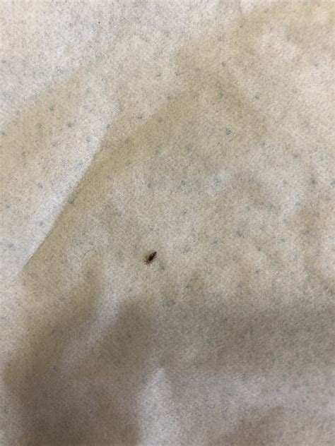 Will Peroxide REALLY Kill Lice? The Shocking Truth!