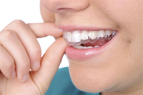 Vinegar can rid your retainer of bacteria and fungus. Saratoga Invisalign Teeth Straightening Treatment | Dr ...