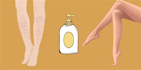 Best Lotion For Extremely Dry Skin On Legs Do This Instead