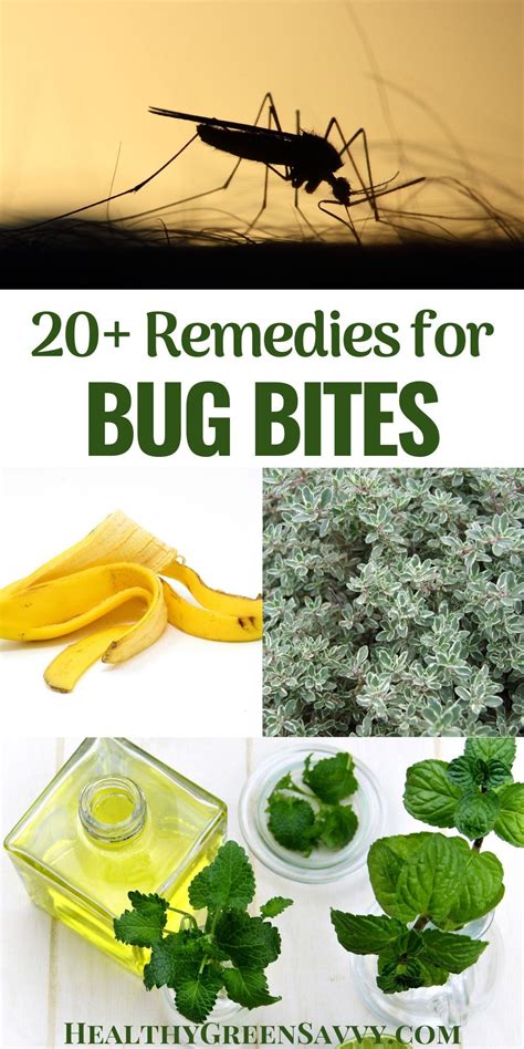 Home Remedies For Mosquito Bites 20 Natural Ways To Stop Itch Fast