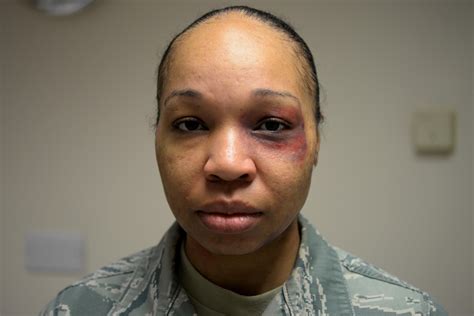 Black Eye Campaign Raises Domestic Violence Awareness Royal Air Force Lakenheath Display