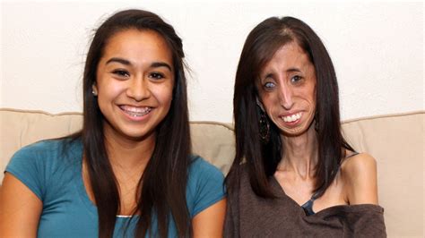 world s thinnest woman lizzie velasquez who has a medical condition has started an