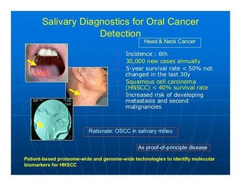 David Wong Advances In Oral Cancer Prevention Applications In Pub