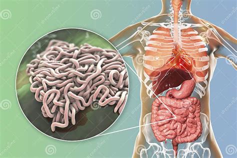 Parasitic Worms In Human Intestine Stock Illustration Illustration Of