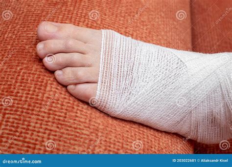 bandaged female leg and lower leg with gauze bandage proper self help for injuries or bruises