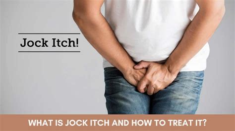 What Is Jock Itch And How To Treat It