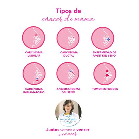 Tipos de cáncer de mama y sus síntomas Dra Tannia Soria Oncóloga Clínica Oncólogos Quito