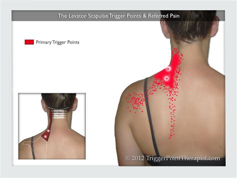 This diagram here just shows the joint capsule itself. Levator Scapulae Trigger Points: Frankenstein Pain ...