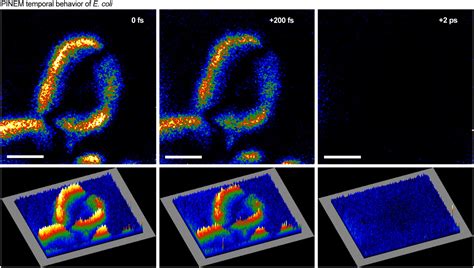 Biological Imaging With 4d Ultrafast Electron Microscopy Pnas
